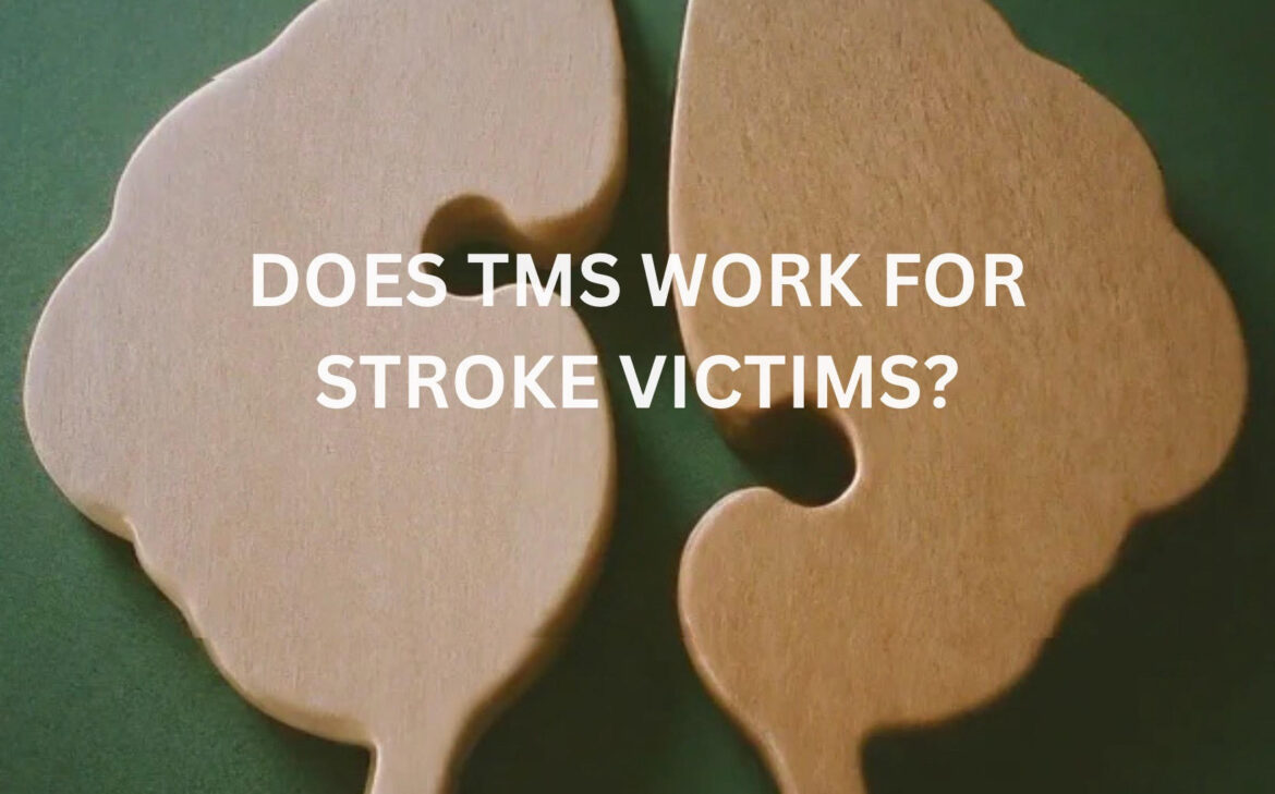 tms for stroke